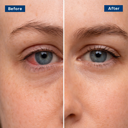 Thermal Eye Relief Mask