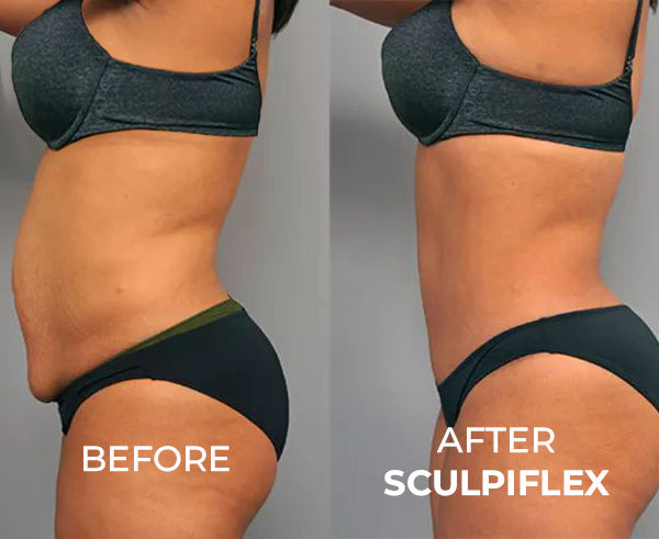 Flex Slim Sculptor